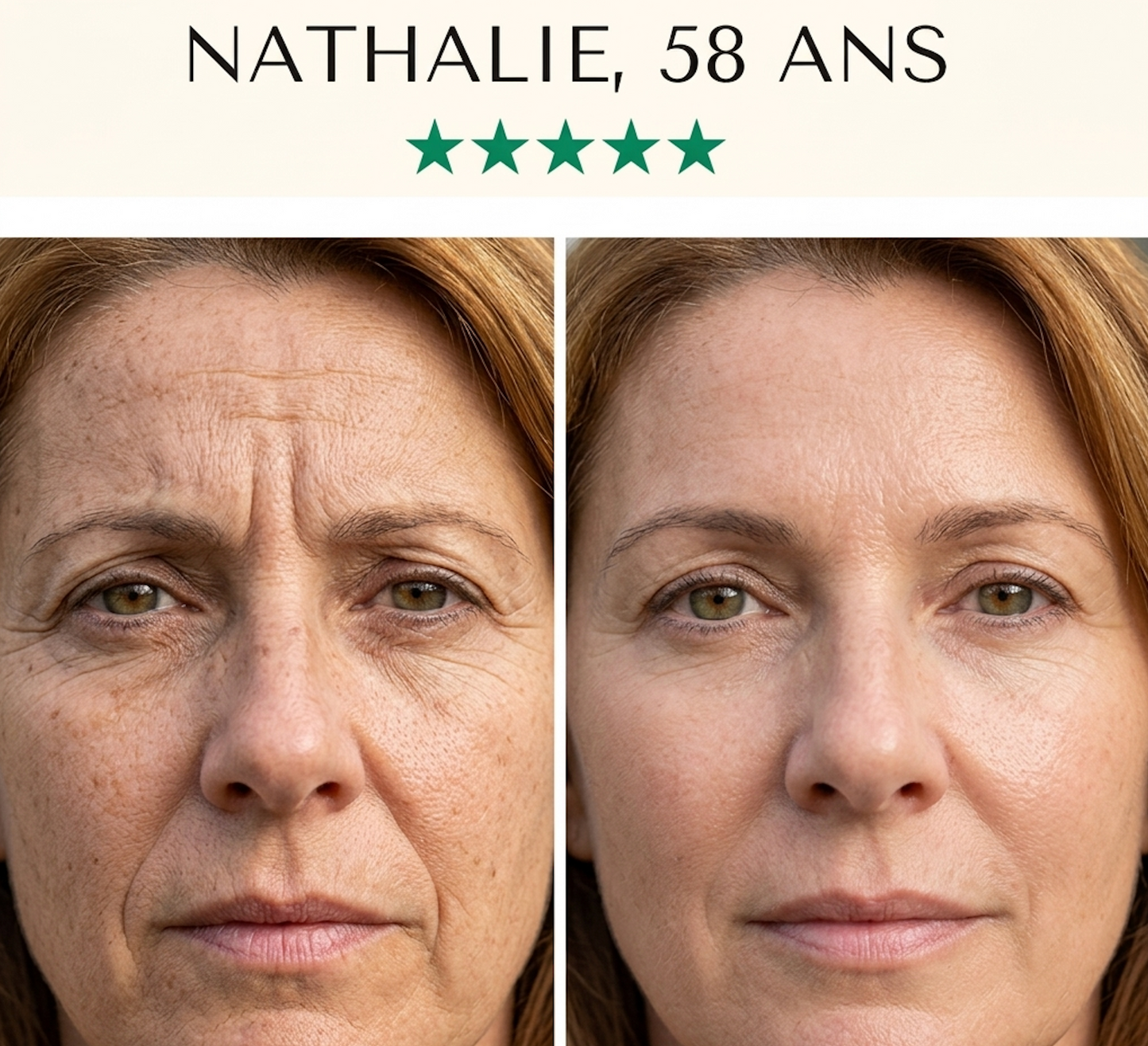 Masque LED Anti-Âge 7-en-1 — Fontana Derm™