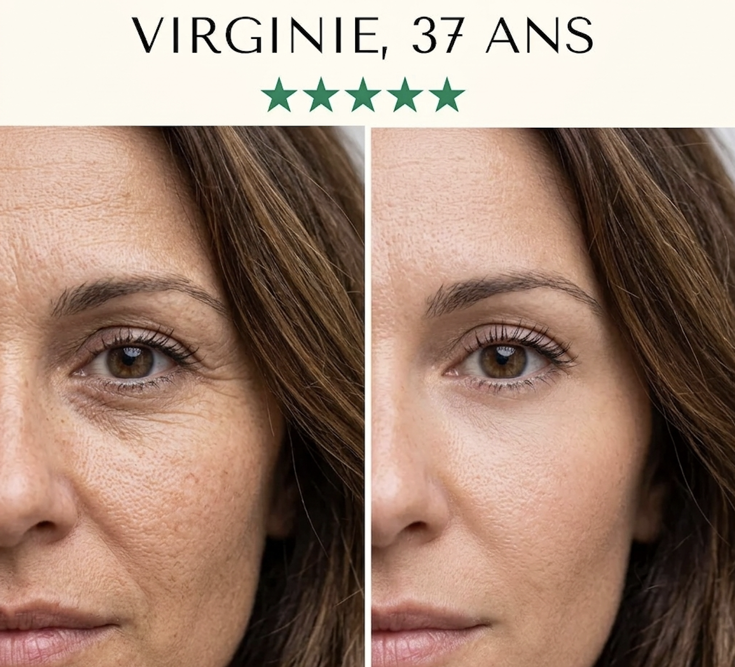 Masque LED Anti-Âge 7-en-1 — Fontana Derm™