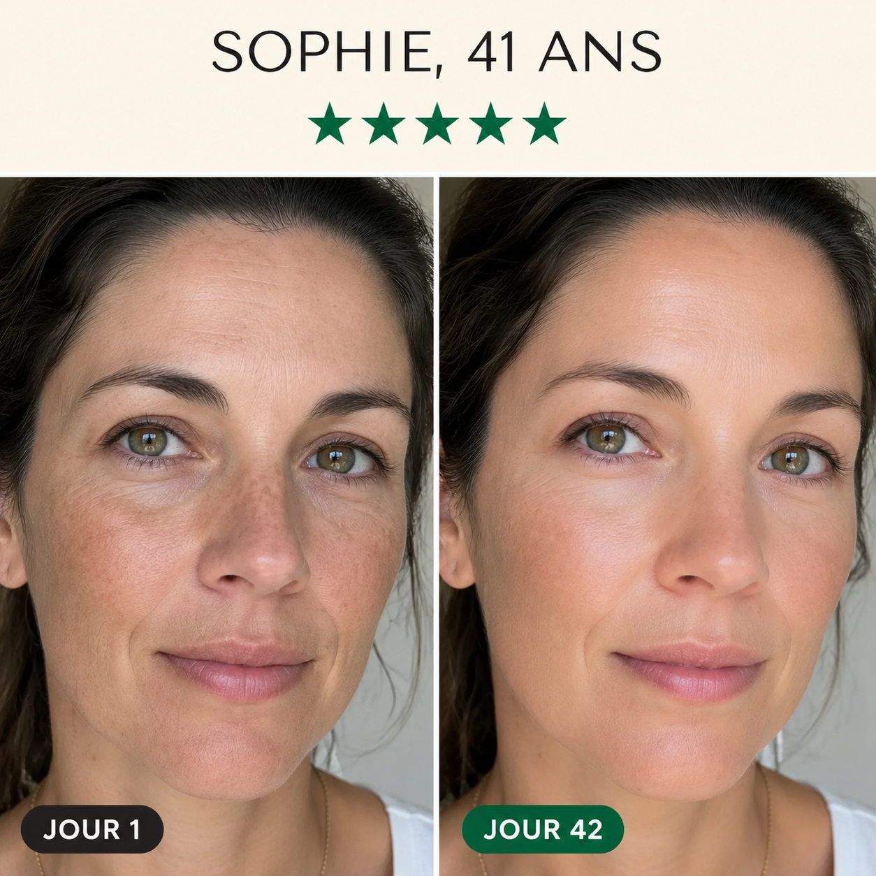 Masque LED Visage – Technologie Anti-Âge Avancée