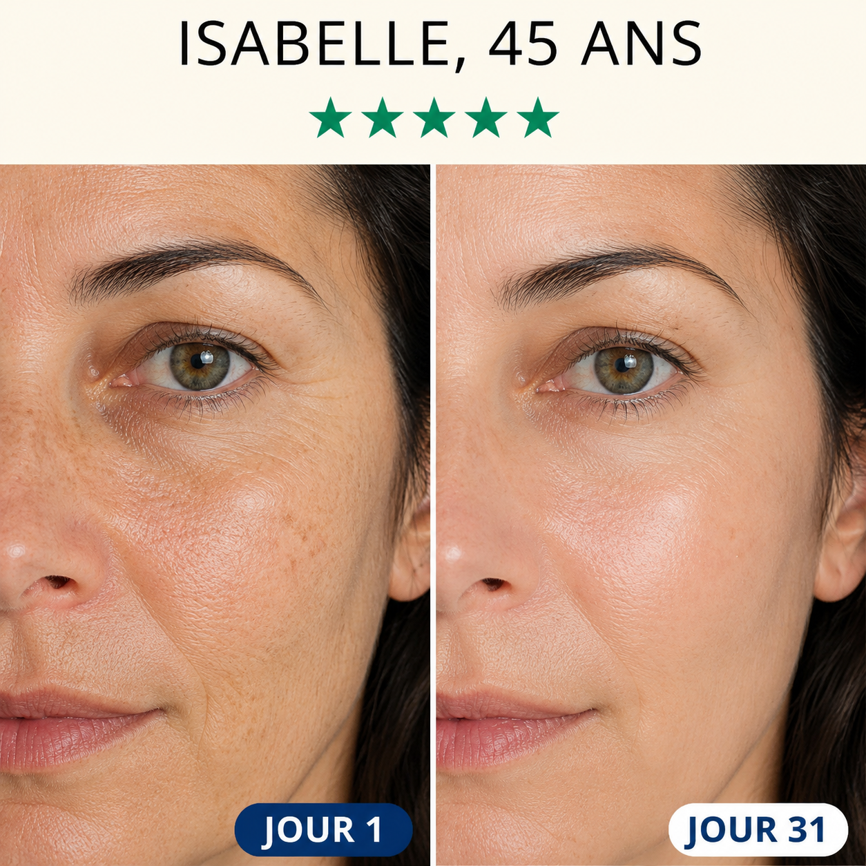 Masque LED Visage – Technologie Anti-Âge Avancée