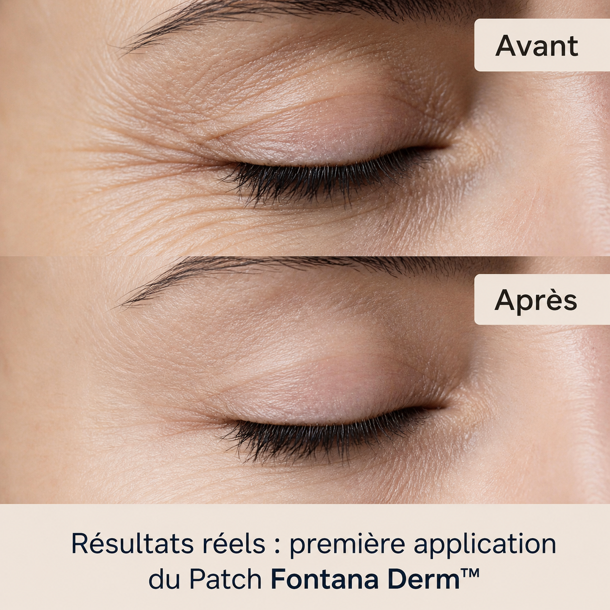 Patchs Liftants Anti-Rides Réutilisables — Fontana Derm™