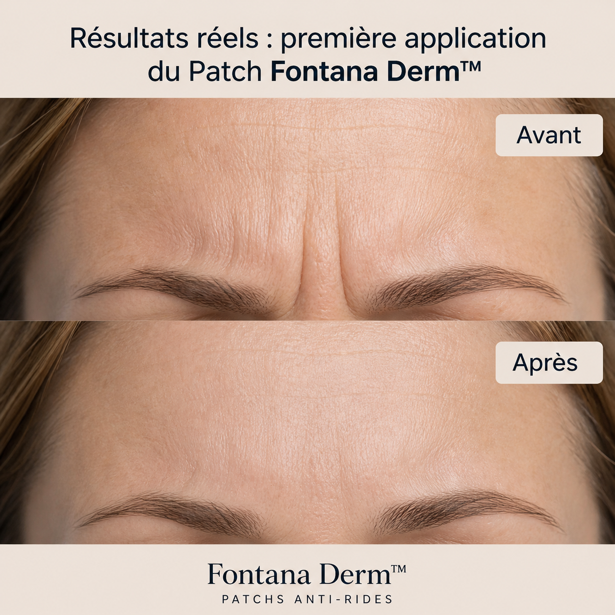 Patchs Liftants Anti-Rides Réutilisables — Fontana Derm™