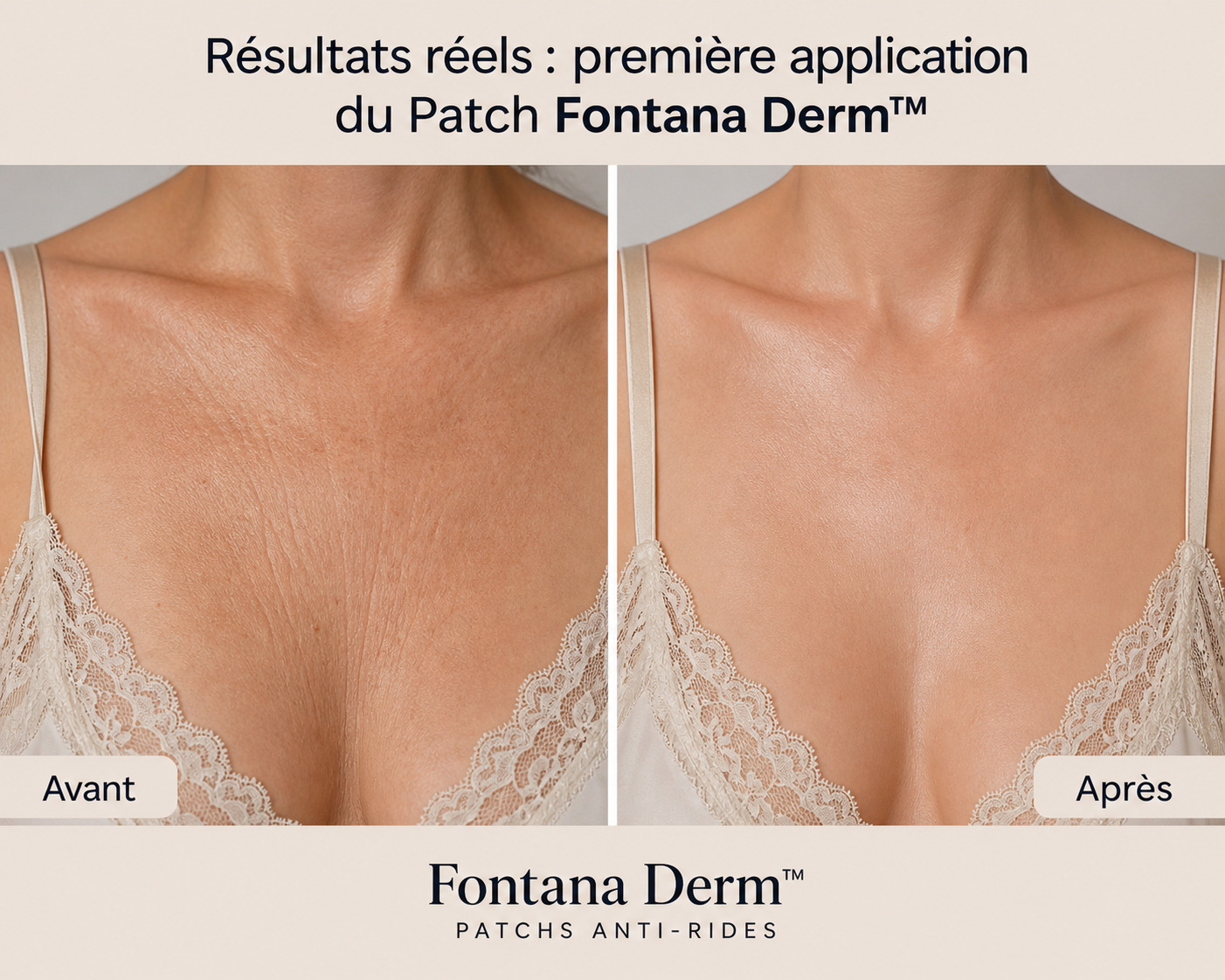 Patchs Liftants Anti-Rides Réutilisables — Fontana Derm™
