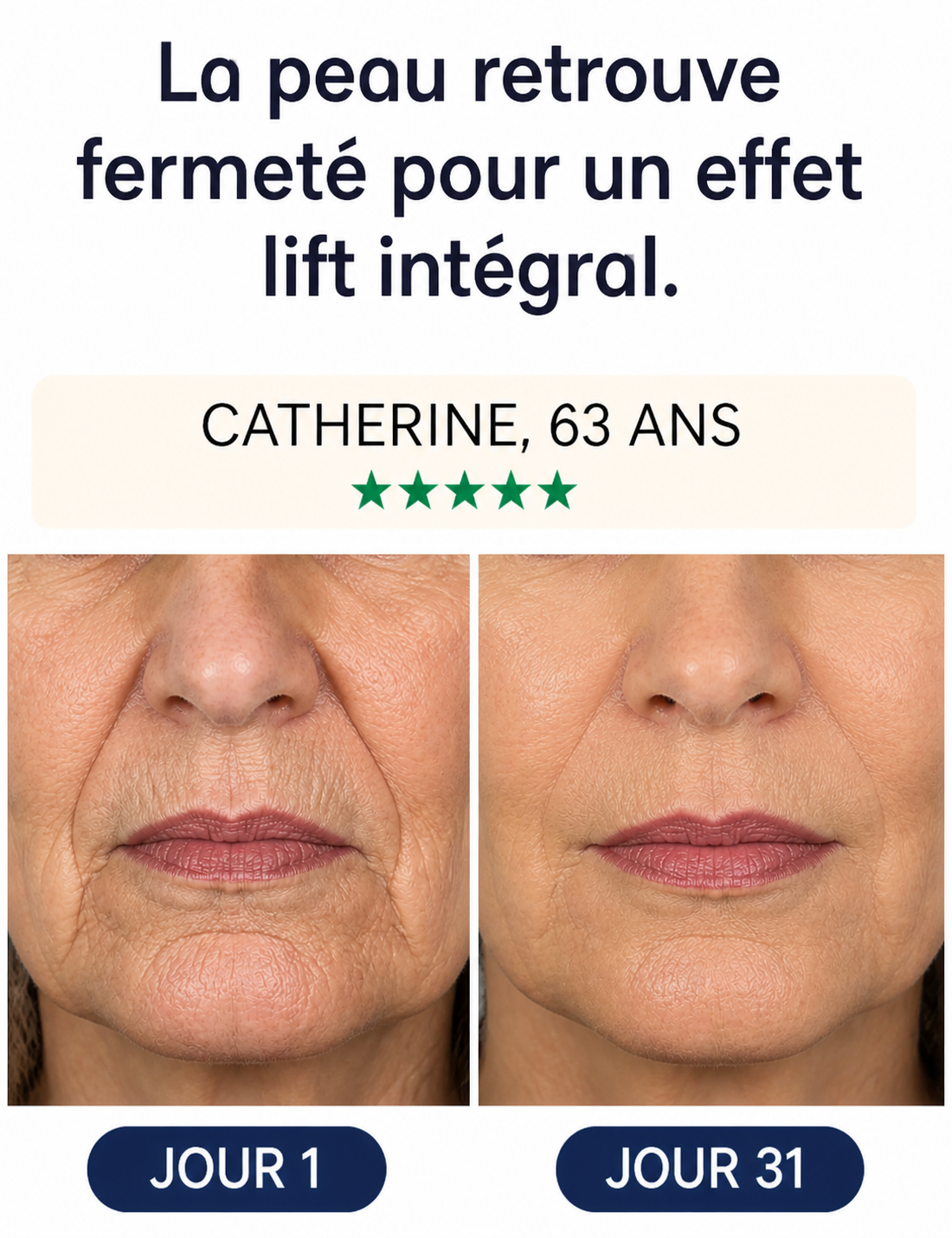 Masque Liftant Réutilisable Intensif — Fontana Derm™