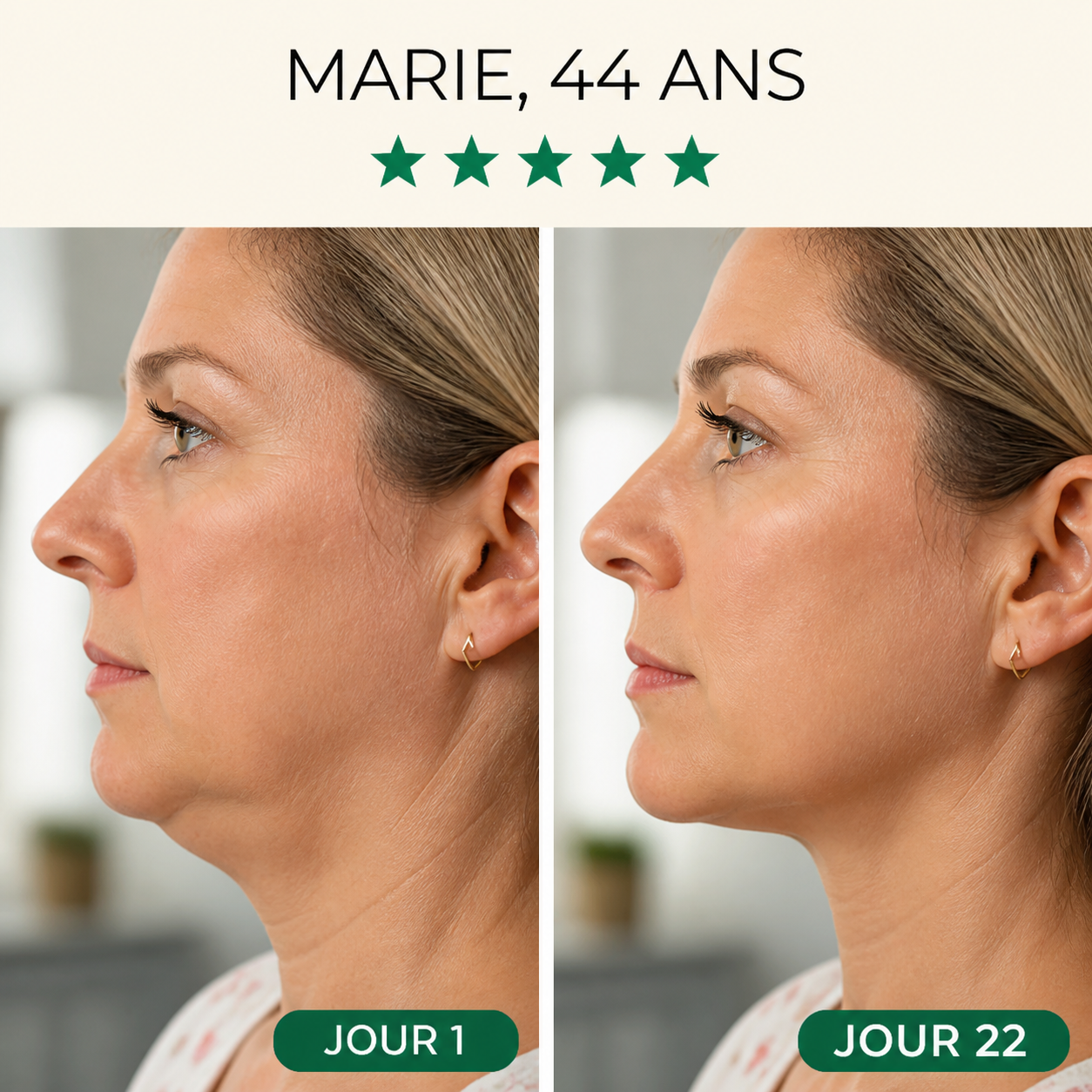 Masque Liftant Réutilisable Intensif — Fontana Derm™