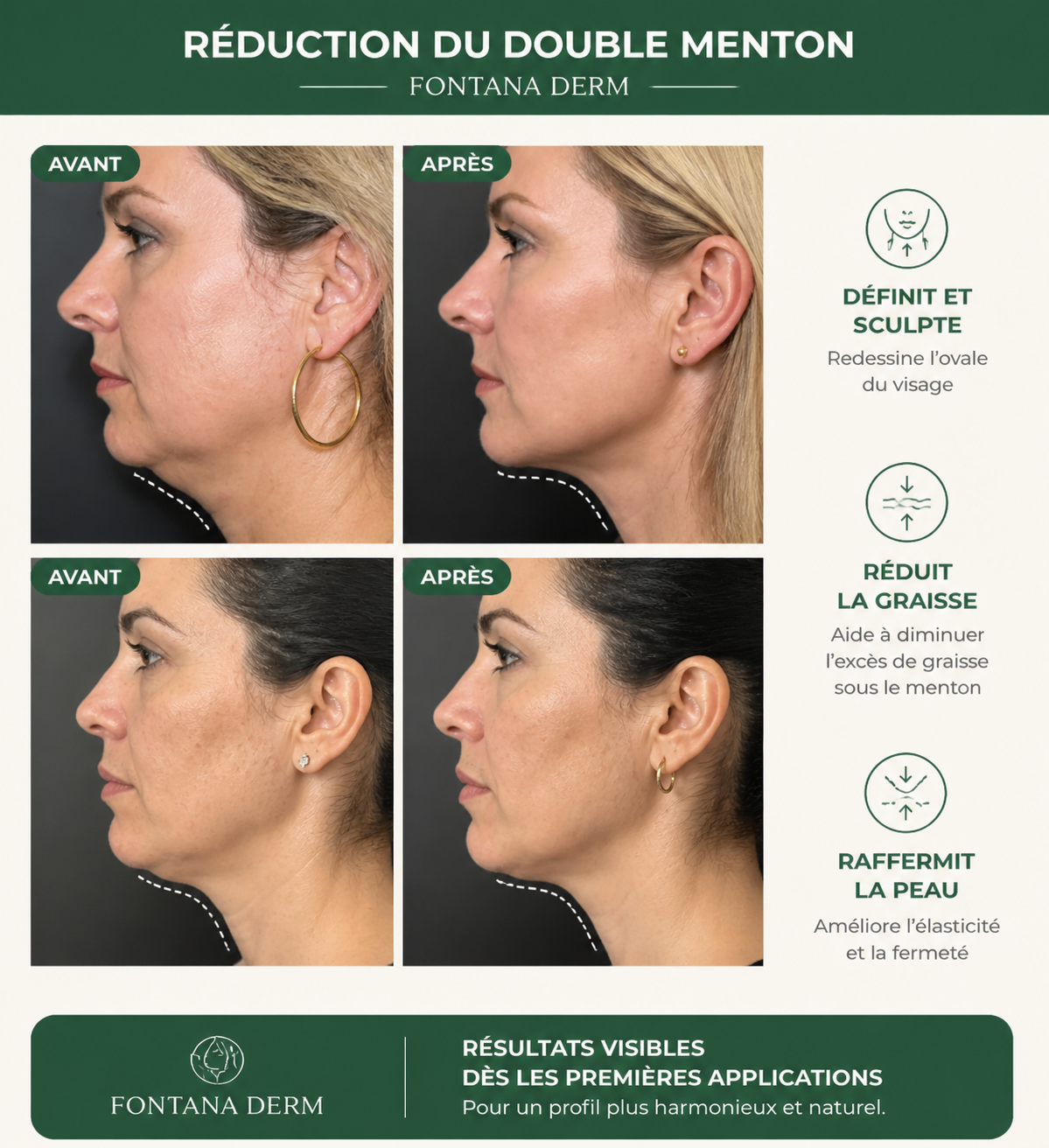 Masque Liftant Réutilisable Intensif — Fontana Derm™