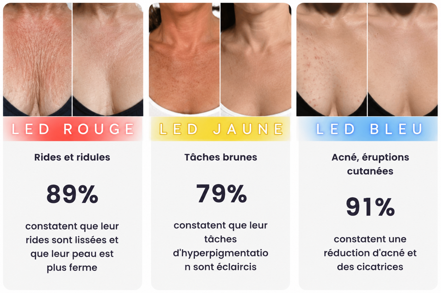 Fontana Derm Masque LED Anti-Âge Ultime – Visage, Cou & Décolleté