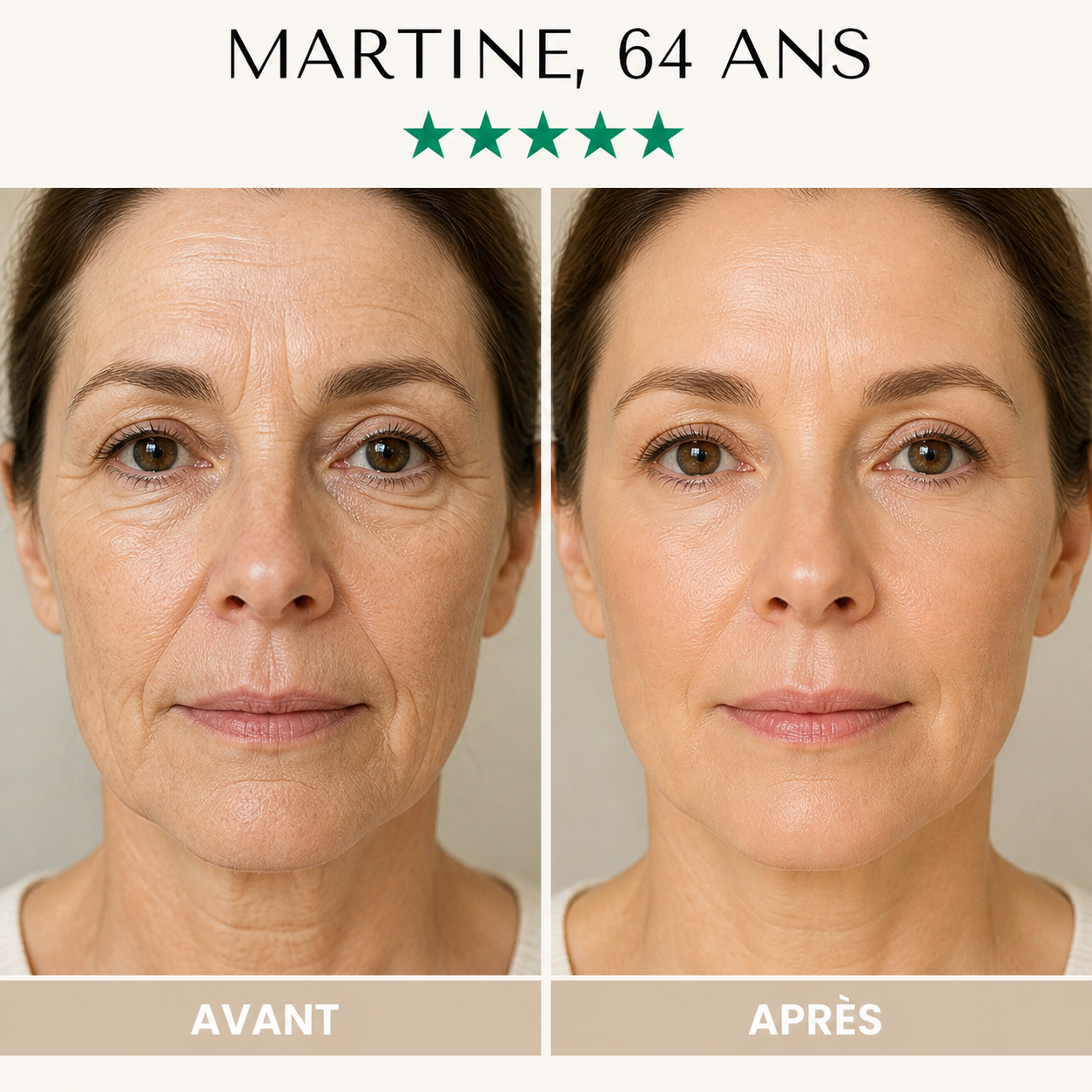 Masque LED Anti-Âge 7-en-1 — Fontana Derm™