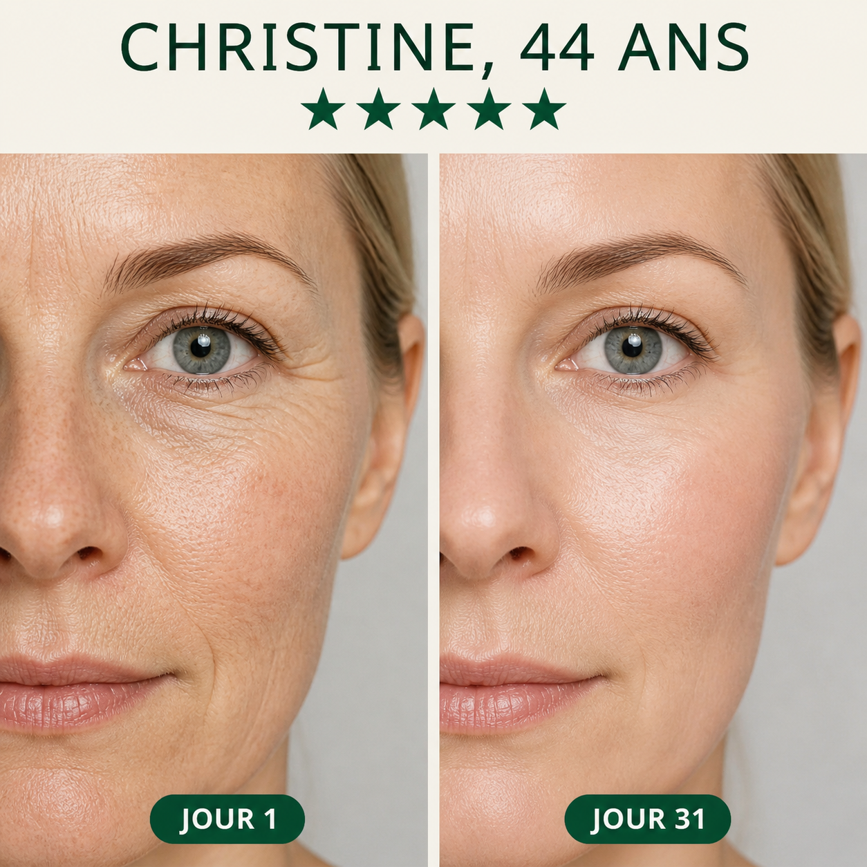 Masque LED Anti-Âge 7-en-1 — Fontana Derm™